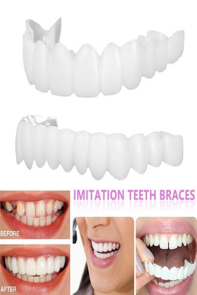 upperlower cosmetic denture polyethylene grills fake tooth cover simulation teeth whitening dental brace oral care beauty snap on4025275, Black
upperlower cosmetic denture polyethylene grills fake tooth cover simulation teeth whitening dental brace oral care beauty snap on4025275, Black