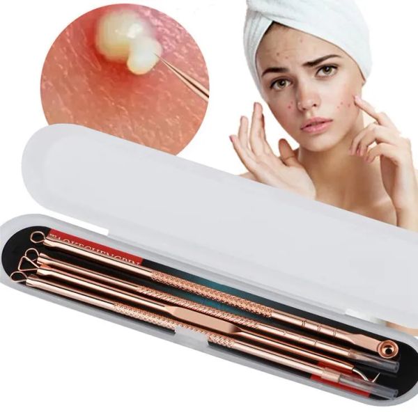 4pcsset blackheads cleaner remover comedone acne beauty facial cleansing extraction tool set blackhead blemish removers tool
4pcsset blackheads cleaner remover comedone acne beauty facial cleansing extraction tool set blackhead blemish removers tool