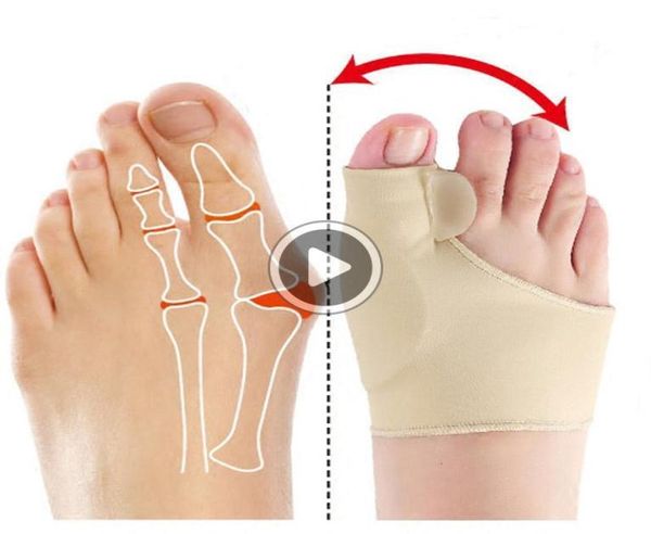 1pair big bone orthopedic bunion correction pedicure socks sile hallux valgus corrector bras toes separator feet care tool5521592, Blue;black
1pair big bone orthopedic bunion correction pedicure socks sile hallux valgus corrector bras toes separator feet care tool5521592, Blue;black