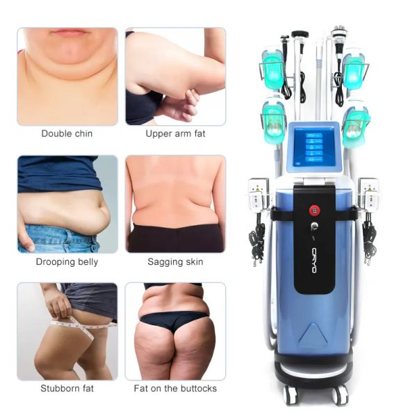 5 in 1 cryolipolysis handle italy fat e cryolipolysis weight loss vacuum cavitation cool mini cryolipolysis machine
5 in 1 cryolipolysis handle italy fat e cryolipolysis weight loss vacuum cavitation cool mini cryolipolysis machine