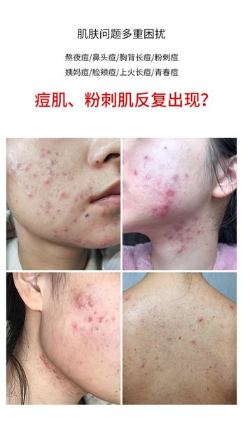 hand soap vjt honey soap silk moisturizing essence makeup removing cleansing soap bamboo charcoal for pregnancy
hand soap vjt honey soap silk moisturizing essence makeup removing cleansing soap bamboo charcoal for pregnancy