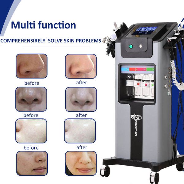 salon beauty equipment hydrafacial oxygen pore cleaner jet peel aqua peeling hydra facial rejuvenation hydro machine
salon beauty equipment hydrafacial oxygen pore cleaner jet peel aqua peeling hydra facial rejuvenation hydro machine