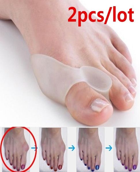 foot treatment silicone toe corrector straightener splint bunion toeprotector toeseparator pads 2pcsset4687498
foot treatment silicone toe corrector straightener splint bunion toeprotector toeseparator pads 2pcsset4687498