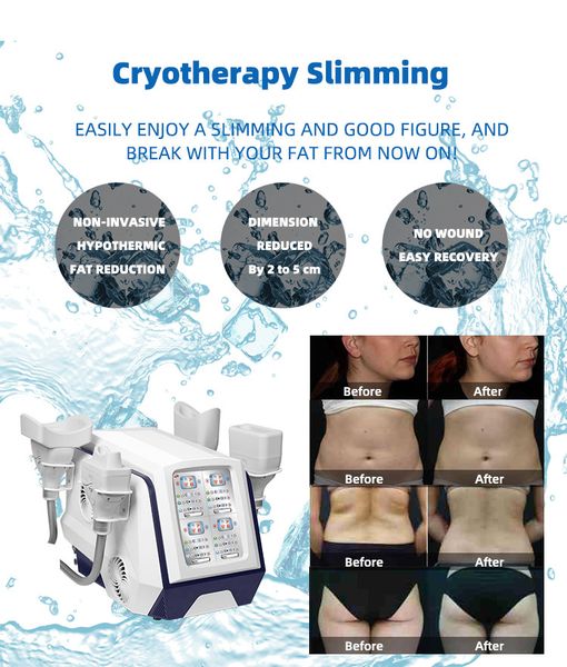 cryolipolisis machine for subcutaneous fat ing layer reduction loss with 4d handles portable system aftercare body sculpting system price
cryolipolisis machine for subcutaneous fat ing layer reduction loss with 4d handles portable system aftercare body sculpting system price