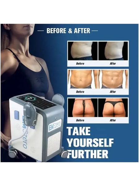 dls-emslim body slimming machine 14 tesla hi-emt body sculpt fat loss emszero with 4 handles build muscle neo pelvice
dls-emslim body slimming machine 14 tesla hi-emt body sculpt fat loss emszero with 4 handles build muscle neo pelvice