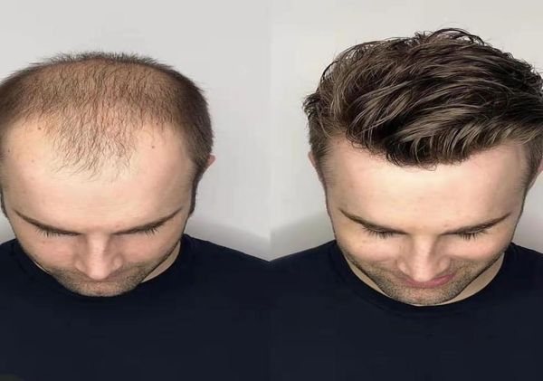 men039s wig super fine swiss lace men toupee 8x10 inches brazilian human hair prosthetic male wigs 4784380, Black
men039s wig super fine swiss lace men toupee 8x10 inches brazilian human hair prosthetic male wigs 4784380, Black