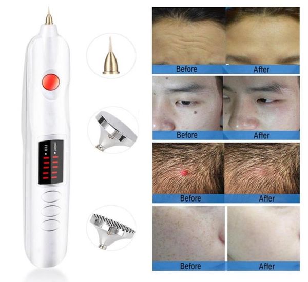 mini laser plasma pen eyelid lifting face lift needle spot removal face freckle wart wrinkle tattoo remover skin care home use bea1740586, Black
mini laser plasma pen eyelid lifting face lift needle spot removal face freckle wart wrinkle tattoo remover skin care home use bea1740586, Black