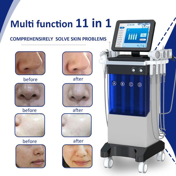 11 in 1 oxygen jet water dermabrasion cleaning face skin care machine hydra dermabrasion machine
11 in 1 oxygen jet water dermabrasion cleaning face skin care machine hydra dermabrasion machine