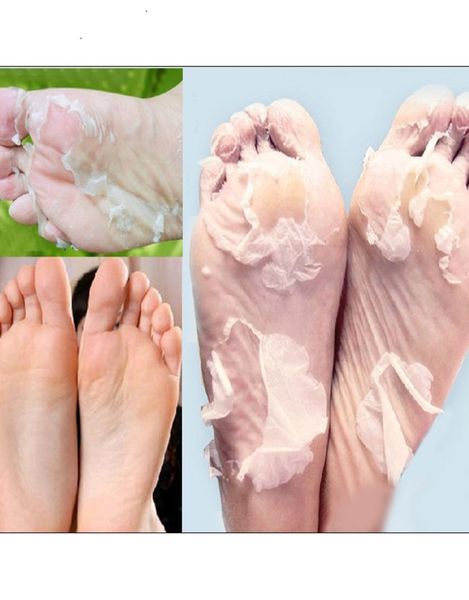 peeling feet mask exfoliating socks baby care pedicure socks remove dead skin cuticles suso socks for pedicure5082026
peeling feet mask exfoliating socks baby care pedicure socks remove dead skin cuticles suso socks for pedicure5082026