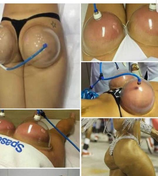 2 cans breast buttocks enhancement pump for lady vacuum cupping body massager chest enhancement cupping therapy device9151785
2 cans breast buttocks enhancement pump for lady vacuum cupping body massager chest enhancement cupping therapy device9151785