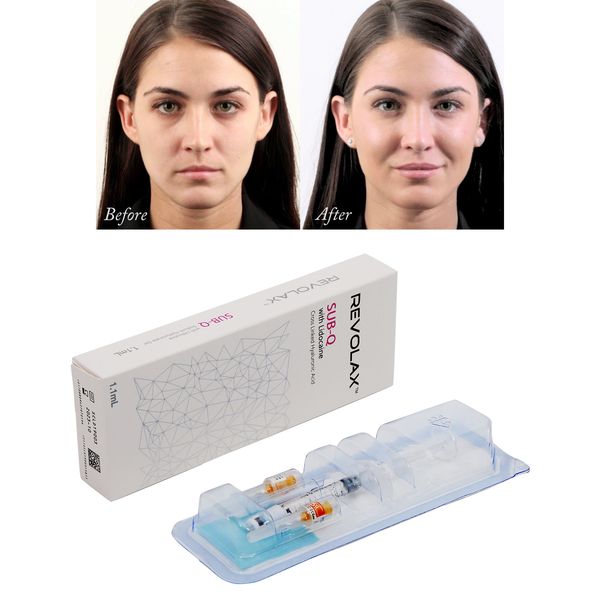 revolax deep filler fine sub-q o juvederms acido hialuronico lip fillers
revolax deep filler fine sub-q o juvederms acido hialuronico lip fillers
