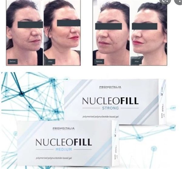 beauty items creams 2022 new italy nucleofill strong age increase collagen production face lifting
beauty items creams 2022 new italy nucleofill strong age increase collagen production face lifting