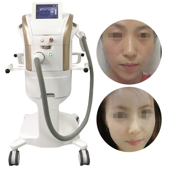 beauty items m22 anti-aging wrinkle removal m22 skin care rejuvenation