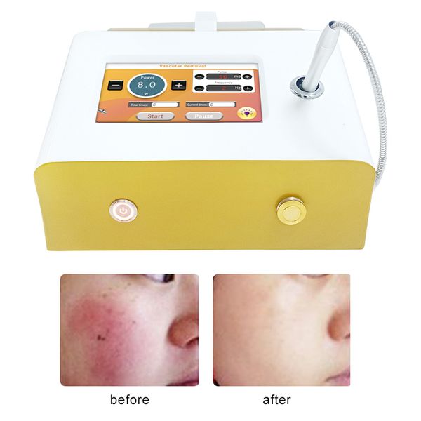 beauty items 30 watt 980nm diode laser spider vein removal machine vascular remove equipment
beauty items 30 watt 980nm diode laser spider vein removal machine vascular remove equipment