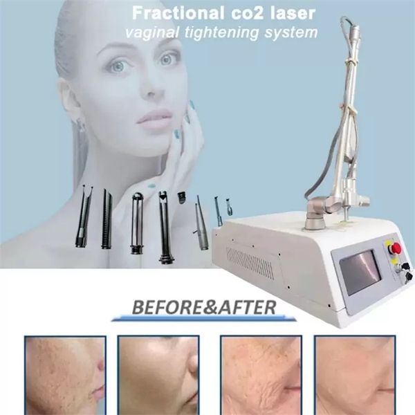 fractional co2 laser beauty items vaginal treatment skin resurfacing acne and scars removal
fractional co2 laser beauty items vaginal treatment skin resurfacing acne and scars removal
