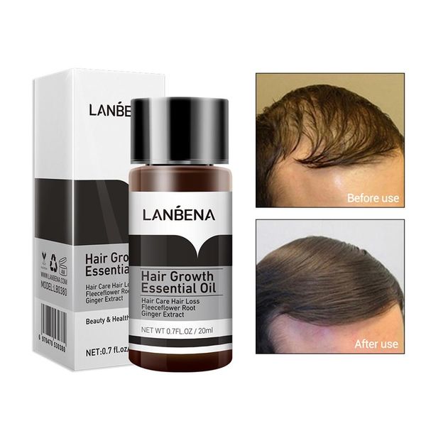 lanbena fast powerful hair growth essence spray 2pcs preventing baldness consolidating anti hairs loss nourish roots hair care268e
lanbena fast powerful hair growth essence spray 2pcs preventing baldness consolidating anti hairs loss nourish roots hair care268e