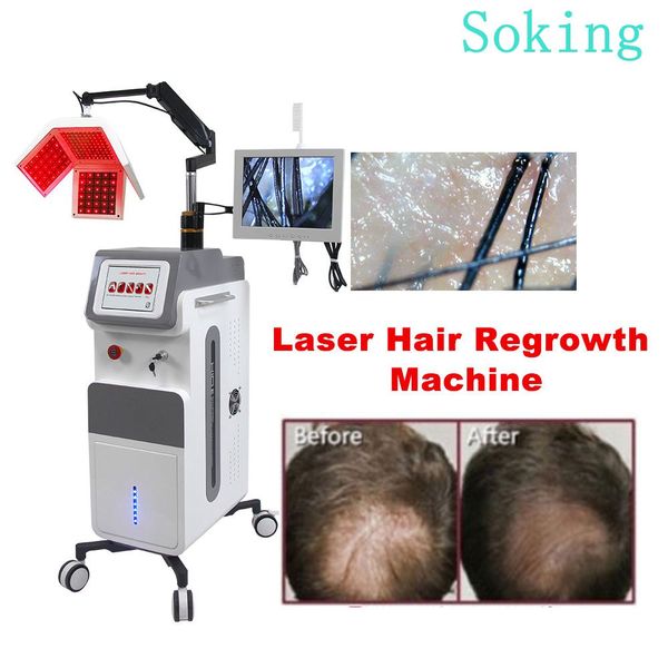diode laser anti-hair loss treatment equipment stimulation scalp care hair growth activa 5 in 1 machine
diode laser anti-hair loss treatment equipment stimulation scalp care hair growth activa 5 in 1 machine