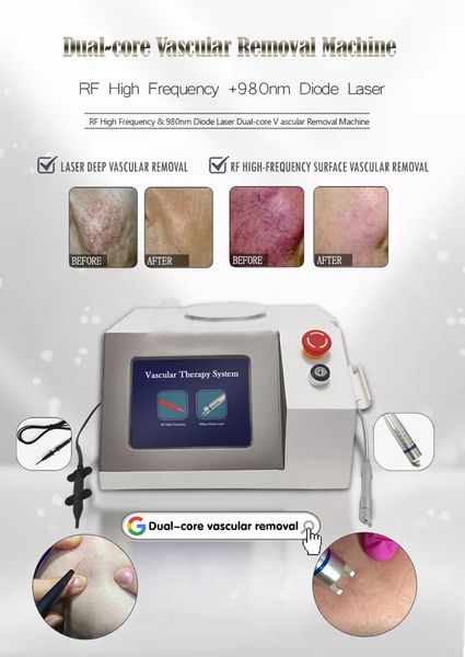 factory price 980nm diode laser other beauty equipment treatment spider vein removal women beauty machine skin regeneration
factory price 980nm diode laser other beauty equipment treatment spider vein removal women beauty machine skin regeneration
