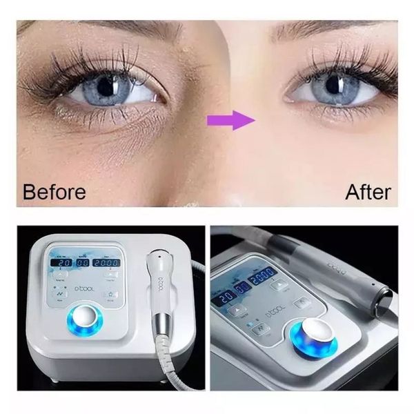 portable cold hammer dcool for skin tightening rejuvenation rf equipment anti puffiness facial heating cooling and electroporation machine
portable cold hammer dcool for skin tightening rejuvenation rf equipment anti puffiness facial heating cooling and electroporation machine