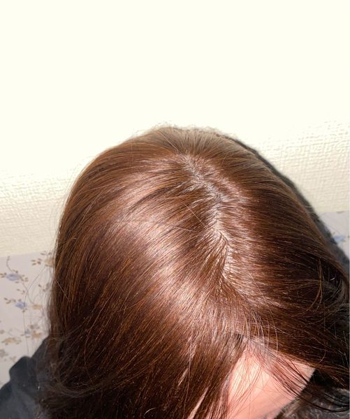 virgin european human hair er real natural silk ers skin base natural scalp with 6x6" large size for thinning hairs 15x16cm brown or bl, Black;brown
virgin european human hair er real natural silk ers skin base natural scalp with 6x6" large size for thinning hairs 15x16cm brown or bl, Black;brown