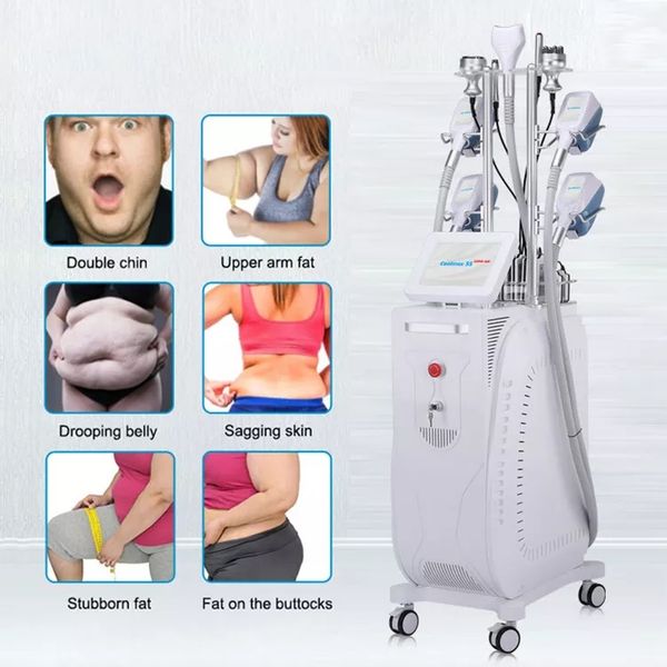 cryolipolysis slimming machine 4 handles fat ing machine cryolipolysis double chin
cryolipolysis slimming machine 4 handles fat ing machine cryolipolysis double chin