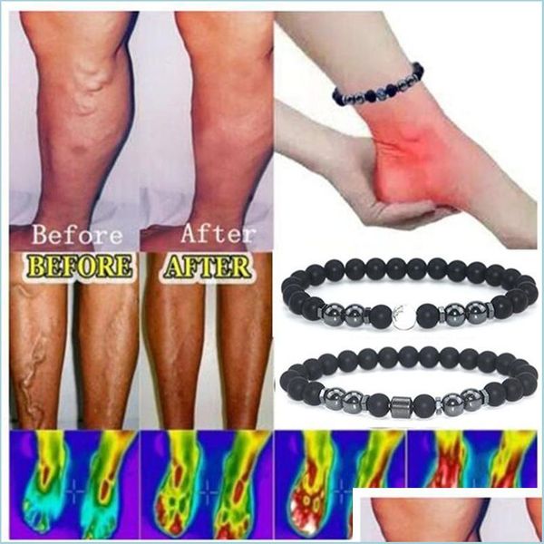 magnetic therapy magnet anklet colorf stone magnetic therapy varicose veins bracelet slimming product health care jewelry for dad mo dhinc
magnetic therapy magnet anklet colorf stone magnetic therapy varicose veins bracelet slimming product health care jewelry for dad mo dhinc