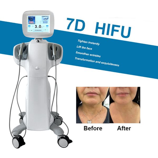 skin tightening 20000 s7d hifu ultramage high-intensity focused ultrasound smas face lifting anti-aging machine 7 cartridges body slimming b
skin tightening 20000 s7d hifu ultramage high-intensity focused ultrasound smas face lifting anti-aging machine 7 cartridges body slimming b