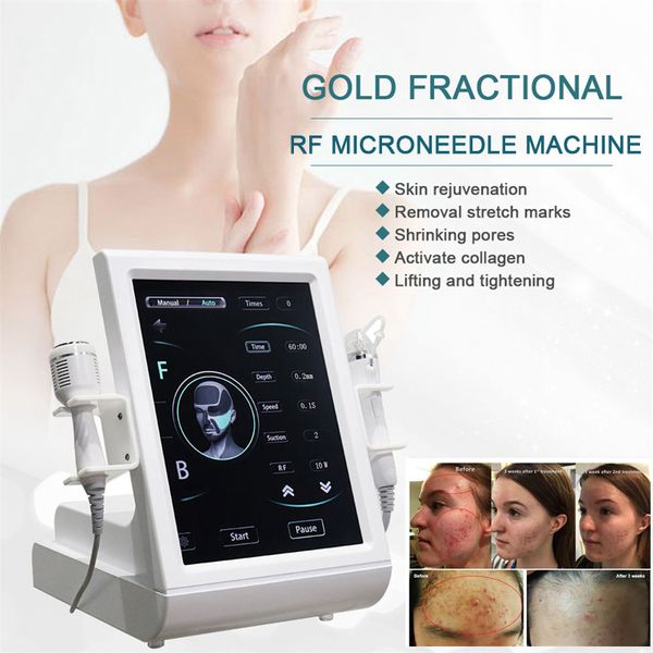 fractional rf microneedling equipment cold hammer acne treatment stretch marks removal micro-needle device gold radiofrequency microneedle s
fractional rf microneedling equipment cold hammer acne treatment stretch marks removal micro-needle device gold radiofrequency microneedle s
