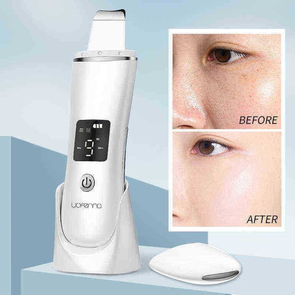 uofenna ultrasonic facial cleansing instrument face lifting beauty deep cleaning and spot removal with wireless base 220513
uofenna ultrasonic facial cleansing instrument face lifting beauty deep cleaning and spot removal with wireless base 220513