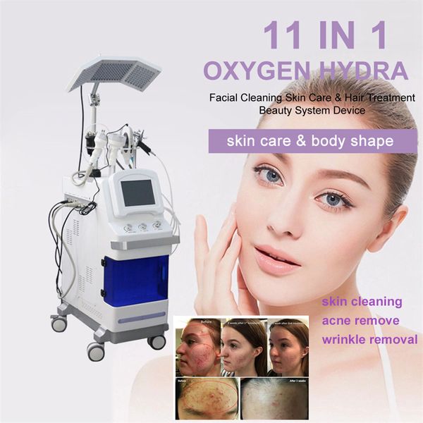 multifunctional facial oxygen jet peel 7 color pdt led light beauty water hydra dermabrasion microdermabrasion machine vacuum bio skin scrub, Black;white
multifunctional facial oxygen jet peel 7 color pdt led light beauty water hydra dermabrasion microdermabrasion machine vacuum bio skin scrub, Black;white