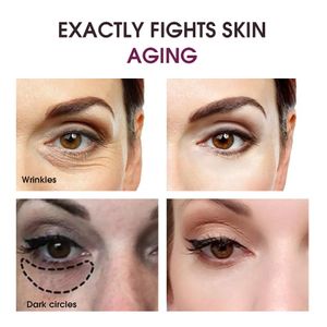 La crema de ojos ligero anti-rugking de Ailke Retinol, con ácido hialurónico, reduce los círculos oscuros, el tratamiento de aclaramiento desordenado