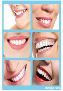 Couvrir entre les dents pour manger de vraies dents artefact incisive dents manquantes temporaires coller vrai et faux appareil orthodontique prothèse dentaire 3872092