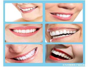 Couvrir entre les dents pour manger de vraies dents artefact incisive dents manquantes temporaires coller vrai et faux appareil orthodontique prothèse dentaire 2391719