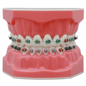 Fil dentaire Typodont Dents orthodontiques Modèle 1 1 Démo standard Enseigner étude avec attaches de ligature Archwire Supports métalliques Tubes buccaux 230421