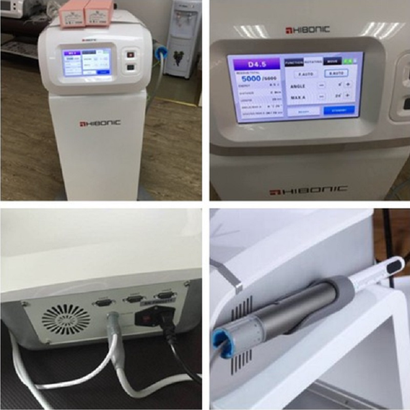 Professional Women Use HIFU Vaginal Tightening Rejuvenation Smoothing High Intensity Focused Ultrasound Private Care HIFU Machine