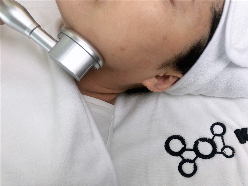 Fractional RF Scar Removal Machine Microneedle RF Ace Removal Machine Radio Frequency RF Face Lifting machine
Fractional RF Scar Removal Machine Microneedle RF Ace Removal Machine Radio Frequency RF Face Lifting machine