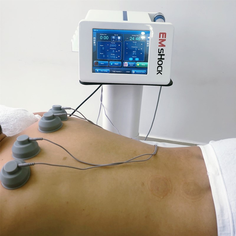 Physical Therapy ShockWave Therapy Acoustic Wave Shockwave Therapy Pain Relief Arthritis Extracorporeal Pulse Activation ED Treatment Device
Physical Therapy ShockWave Therapy Acoustic Wave Shockwave Therapy Pain Relief Arthritis Extracorporeal Pulse Activation ED Treatment Device