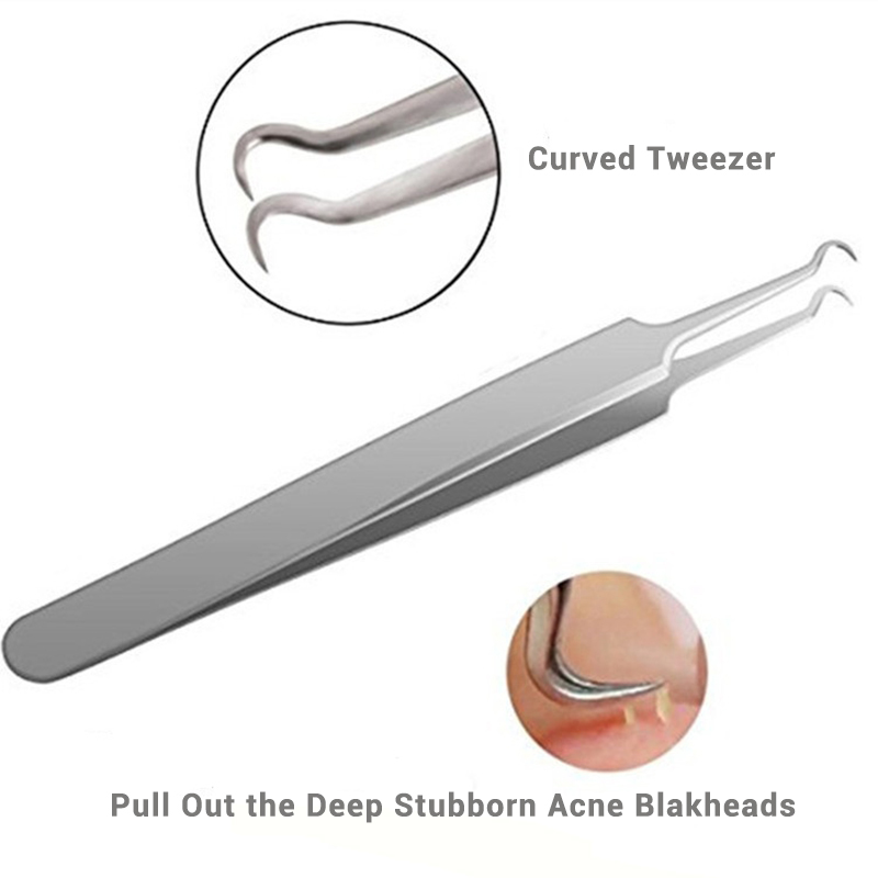 5pcs Best Blackhead Extractor Tool Set Stainless Acne Needle Pimple Tweezers Blackhead Comedone Acne Extractor Skin Care Tool