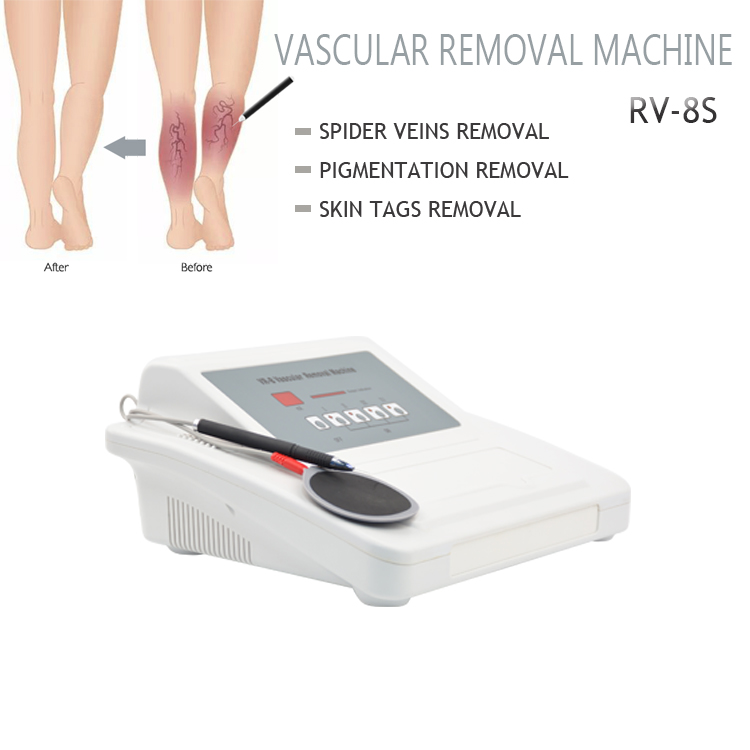 Top selling red blood vascular removal face spider veins remove treatment redness remover beauty equipment spa salon clinic use machine
Top selling red blood vascular removal face spider veins remove treatment redness remover beauty equipment spa salon clinic use machine