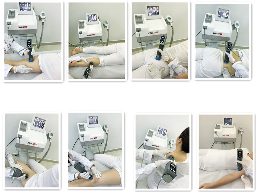 Hot sale shock wave machine with cryolipolysis for body slimming/ High quality cryotherapy machine with shock wave
Hot sale shock wave machine with cryolipolysis for body slimming/ High quality cryotherapy machine with shock wave