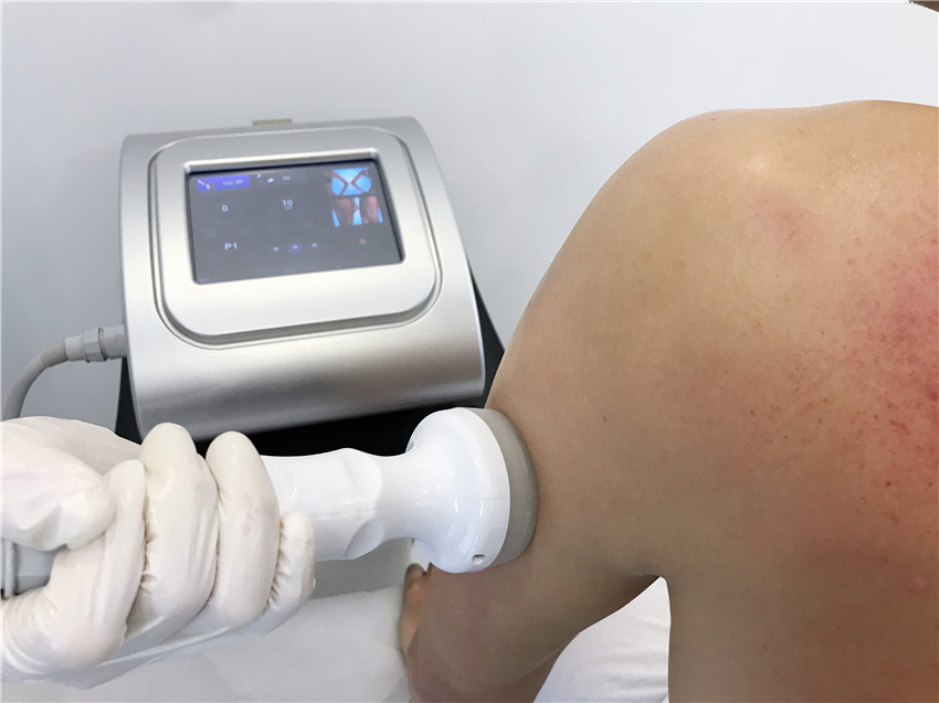 LED therapy vacuum sucking RF facial lifting slimming machine / Vacuum Bipolar RF for eyes face body slimming
LED therapy vacuum sucking RF facial lifting slimming machine / Vacuum Bipolar RF for eyes face body slimming