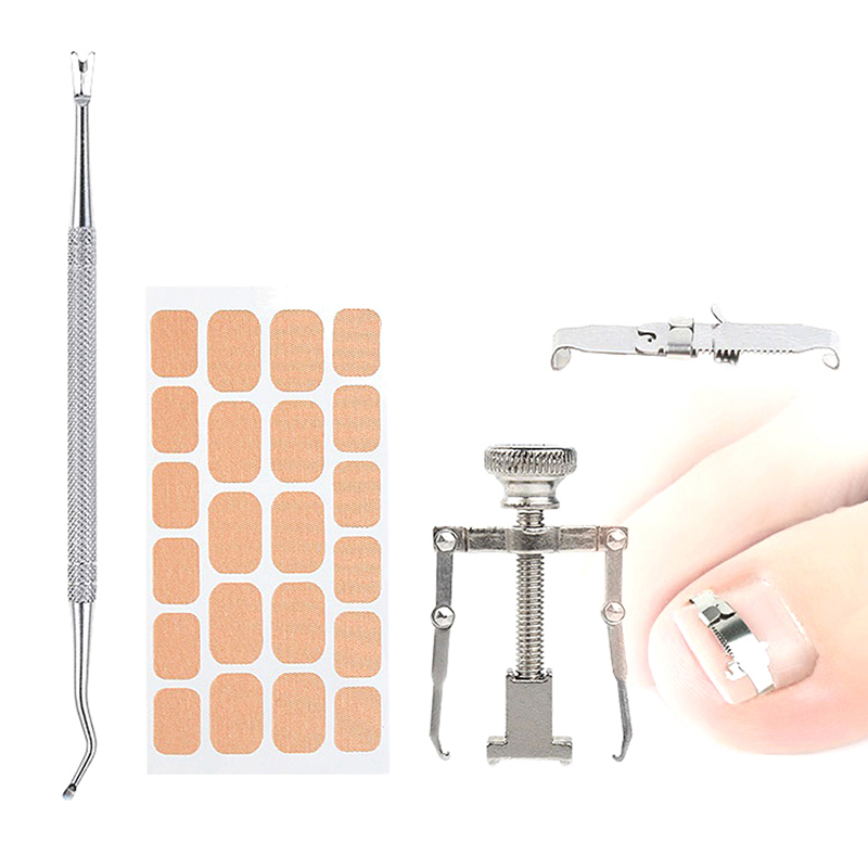 Ingrown Toenail Correction Tool Set Nail Pedicure Elastic Patch Straightening Clip Brace Bunion Corrector
Ingrown Toenail Correction Tool Set Nail Pedicure Elastic Patch Straightening Clip Brace Bunion Corrector