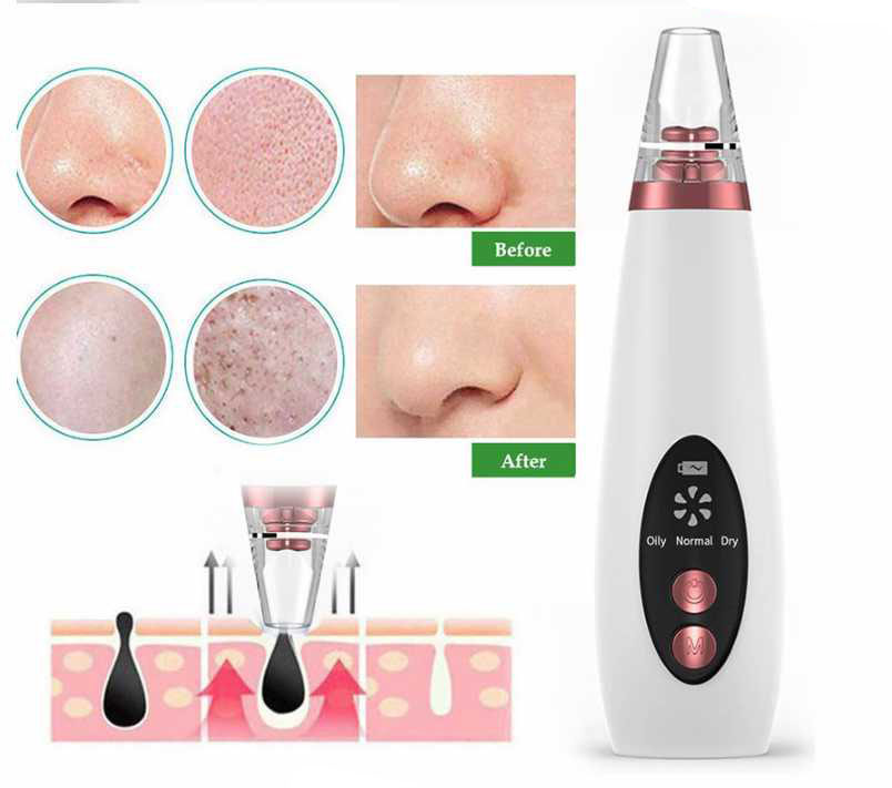 Blackhead Remover Vacuum Pore Cleaner Electric Nose Face Deep Cleansing Skin Care Machine Birthday Gift Beauty Tool Drop Ship
Blackhead Remover Vacuum Pore Cleaner Electric Nose Face Deep Cleansing Skin Care Machine Birthday Gift Beauty Tool Drop Ship