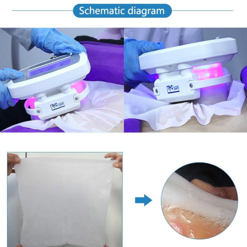 Antifreeze Membranes Antifreezing Antcryo Membrane Cool Cryo Pad Anti Freeze Criolipolisis
