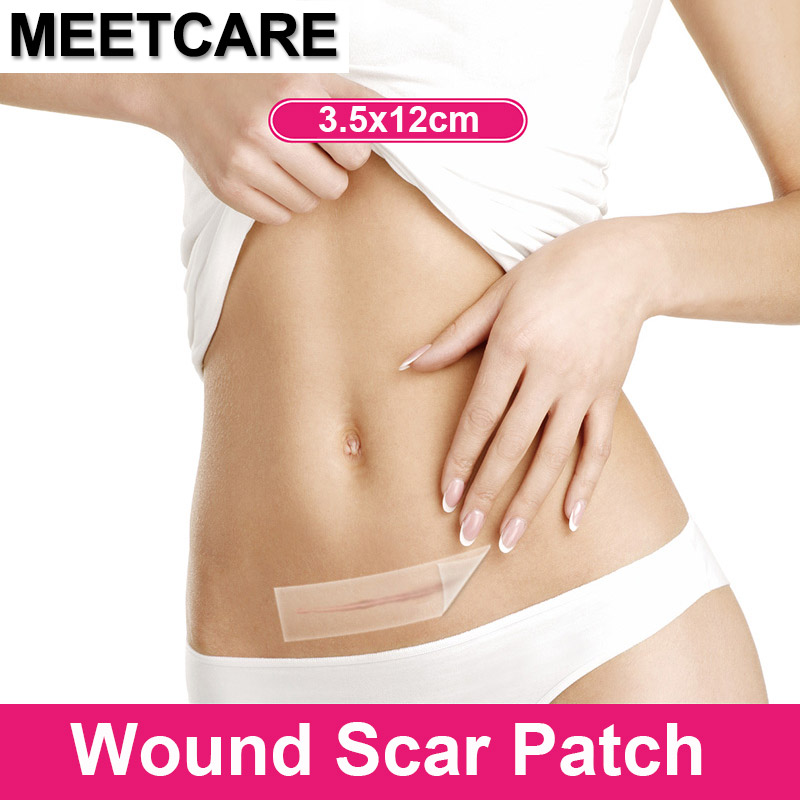 Medical Scar Away Patch Silicone Gel Sheet Wound Marks Removal Cesarean Section Hypertrophic Keloid Skin Scars Therapy Treatment
Medical Scar Away Patch Silicone Gel Sheet Wound Marks Removal Cesarean Section Hypertrophic Keloid Skin Scars Therapy Treatment