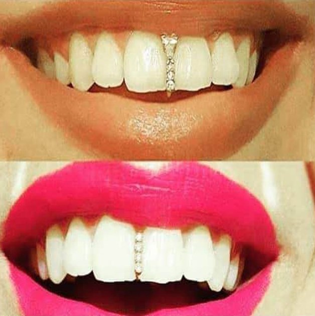 Unisex Hip Hop Teeth Caps Fashion Crystal Teeth Cover Decor Braces Grills Tooth Cap Cosplay Jewelry Body Piercing Accessories
Unisex Hip Hop Teeth Caps Fashion Crystal Teeth Cover Decor Braces Grills Tooth Cap Cosplay Jewelry Body Piercing Accessories