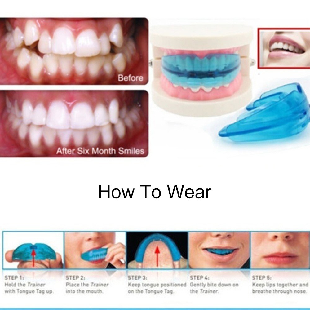 

1pc Dental Tooth Orthodontic Appliance Trainer With Denture Case Teeth Alignment Braces Protector Silicone Corrector Mouth Guard For Teeth