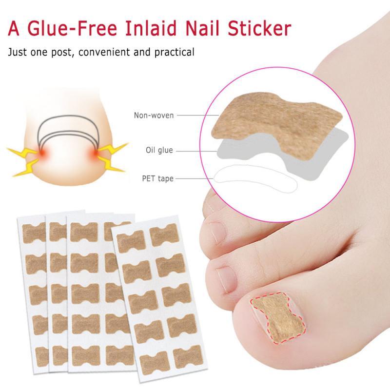 1/5Pcs Nail Strips Anti-roll Nail Free Glue Toe Inlay Corrector Patch Correction Stickers Toenails Care Foot care, 1pcs
1/5Pcs Nail Strips Anti-roll Nail Free Glue Toe Inlay Corrector Patch Correction Stickers Toenails Care Foot care, 1pcs