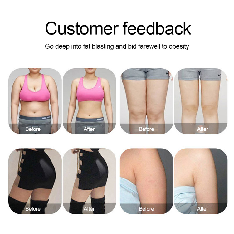 Body Shaping machine EMSlim Muscle Building muscles stimulation devices Fat Removal Technology EMShape free shippment