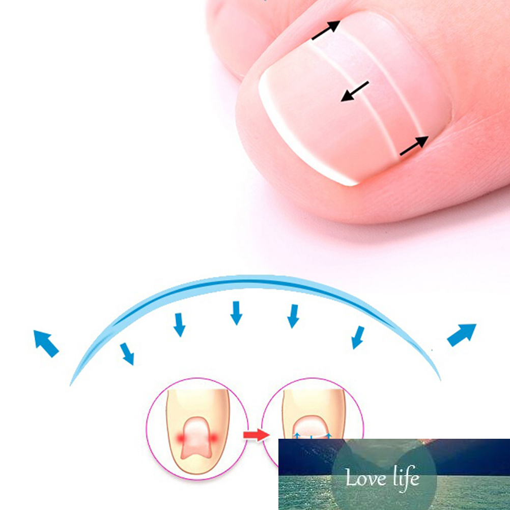 HOT! 1PC Ingrown Toe Nail Correction Sticker Patch Paronychia Correction File Acronyx Wire Corrector Foot Care Tool